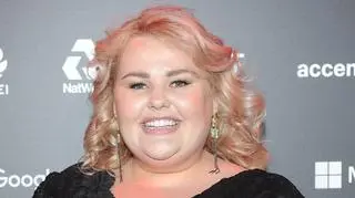 Kinga Zawodnik schudła ponad 50 kg. Zaskoczyła kolejną metamorfozą. "Nawet buzia wygląda inaczej"