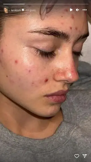 Córka Heidi Klum pokazała się bez makijażu