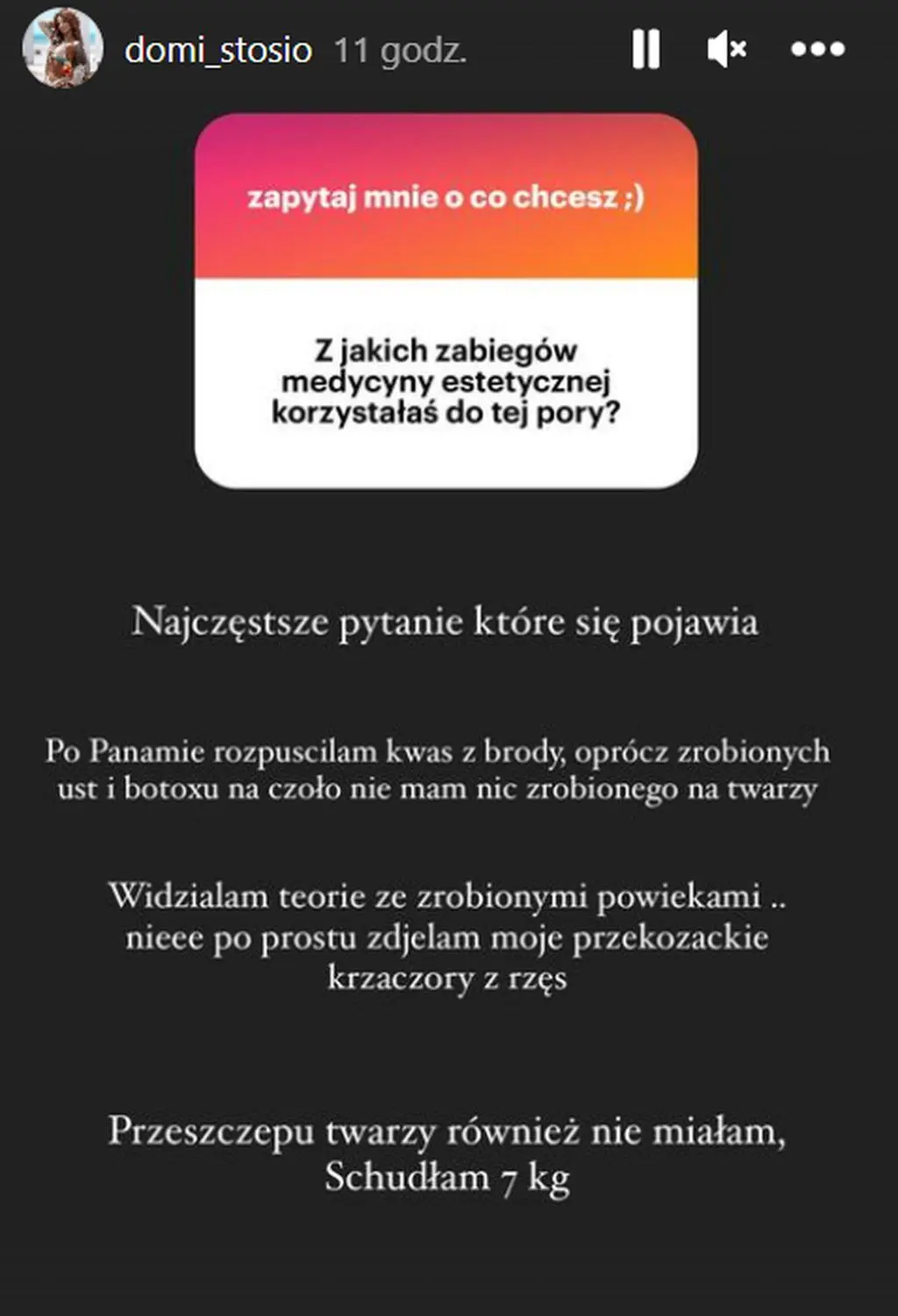 "Hotel Paradise All Stars". Dominika Stosio o zabiegach medycyny estetycznej