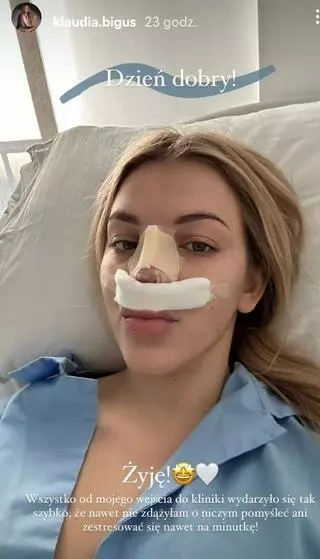Klaudia Bigus pokazała zdjęcie po operacji