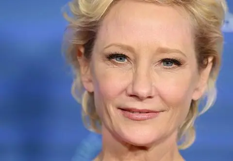 Anne Heche została dawczynią organów. Uratowała osiem osób