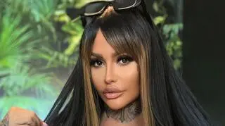 Laluna z "Królowych życia" o 7 nowych zabiegach plastycznych. Co zmieni?