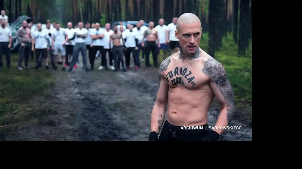 Paradontoza - jak odzyskać piękny uśmiech?
