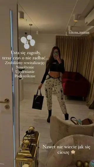 Klaudia Nieścior cofnęła zabieg powiększania ust