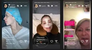 "Diabelnie boskie". Julia von Stein przeszła operację nosa