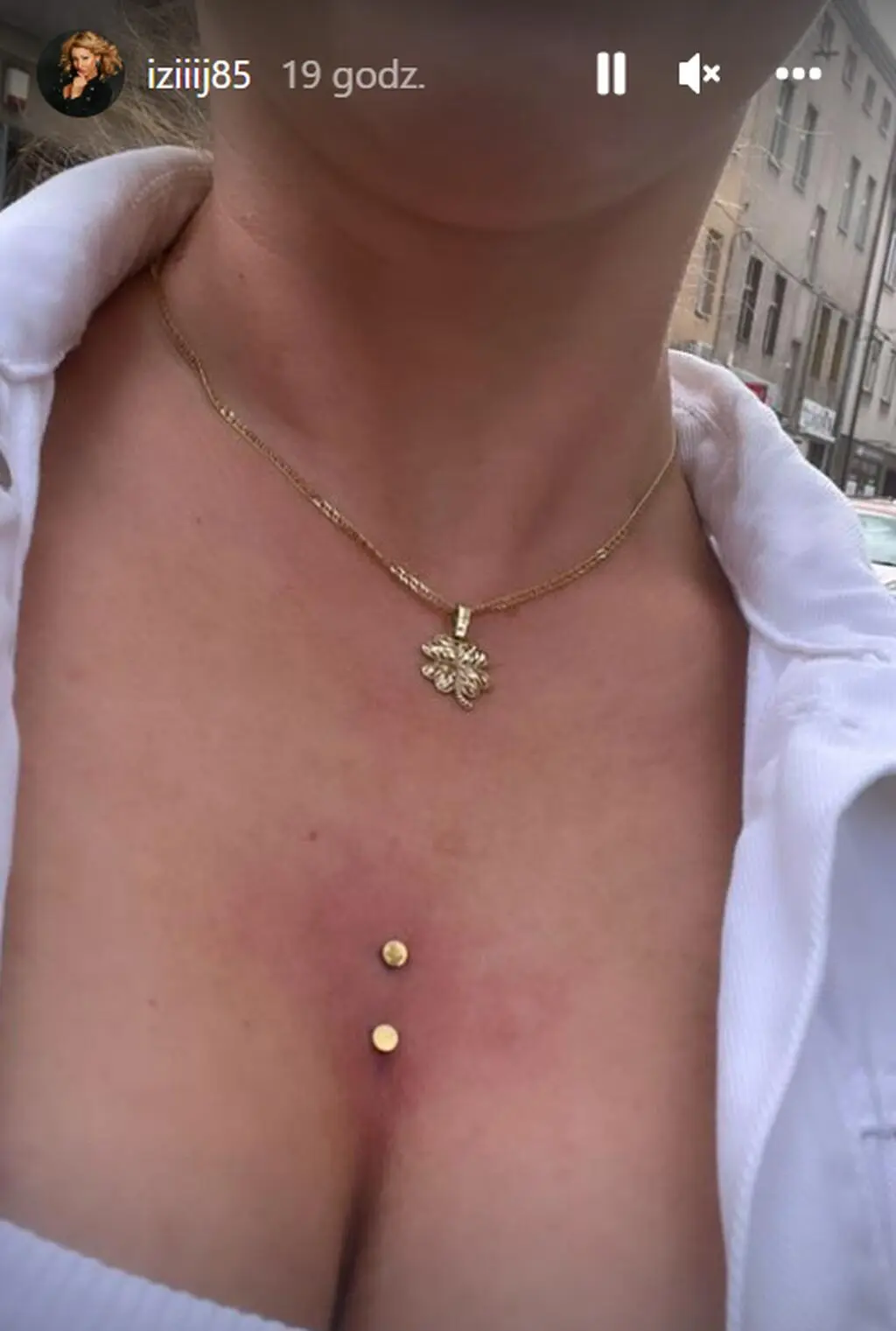 Iza ze "Ślubu od pierwszego wejrzenia" zrobiła piercing