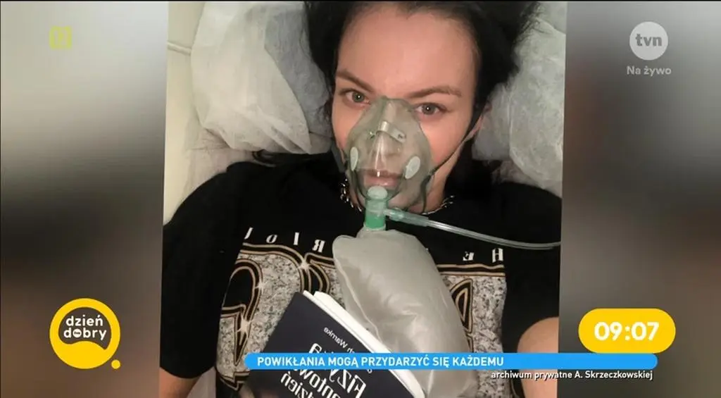 Agnieszka Skrzeczkowska z "Top Model" miała martwicę