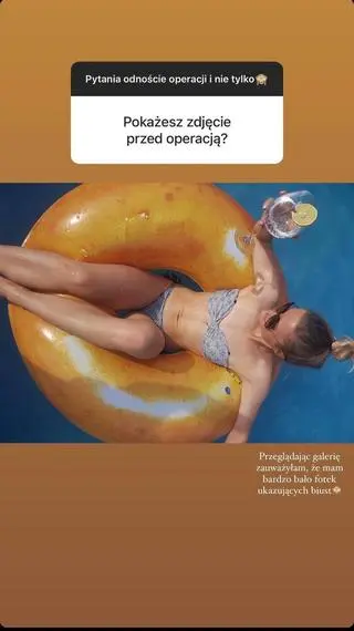 "True Love". Oliwia Ścierczak pokazała zdjęcie sprzed operacji