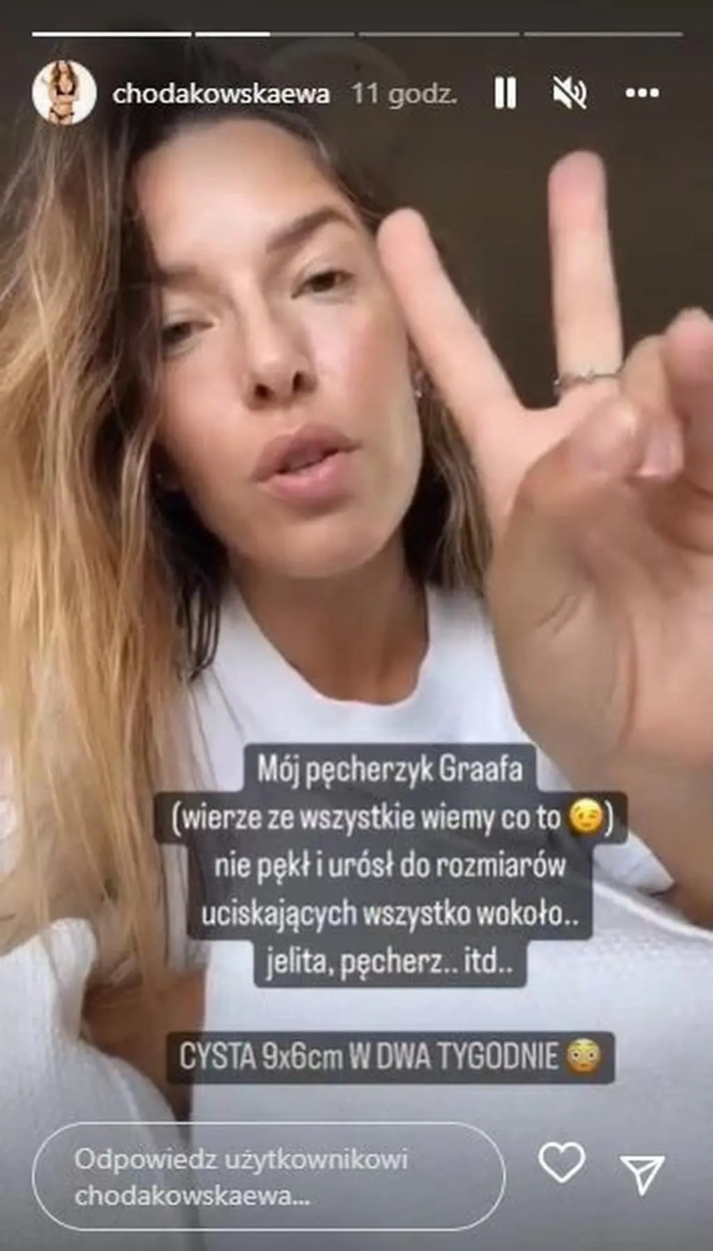 Ewa Chodakowska opowiedziała o problemach ze zdrowiem