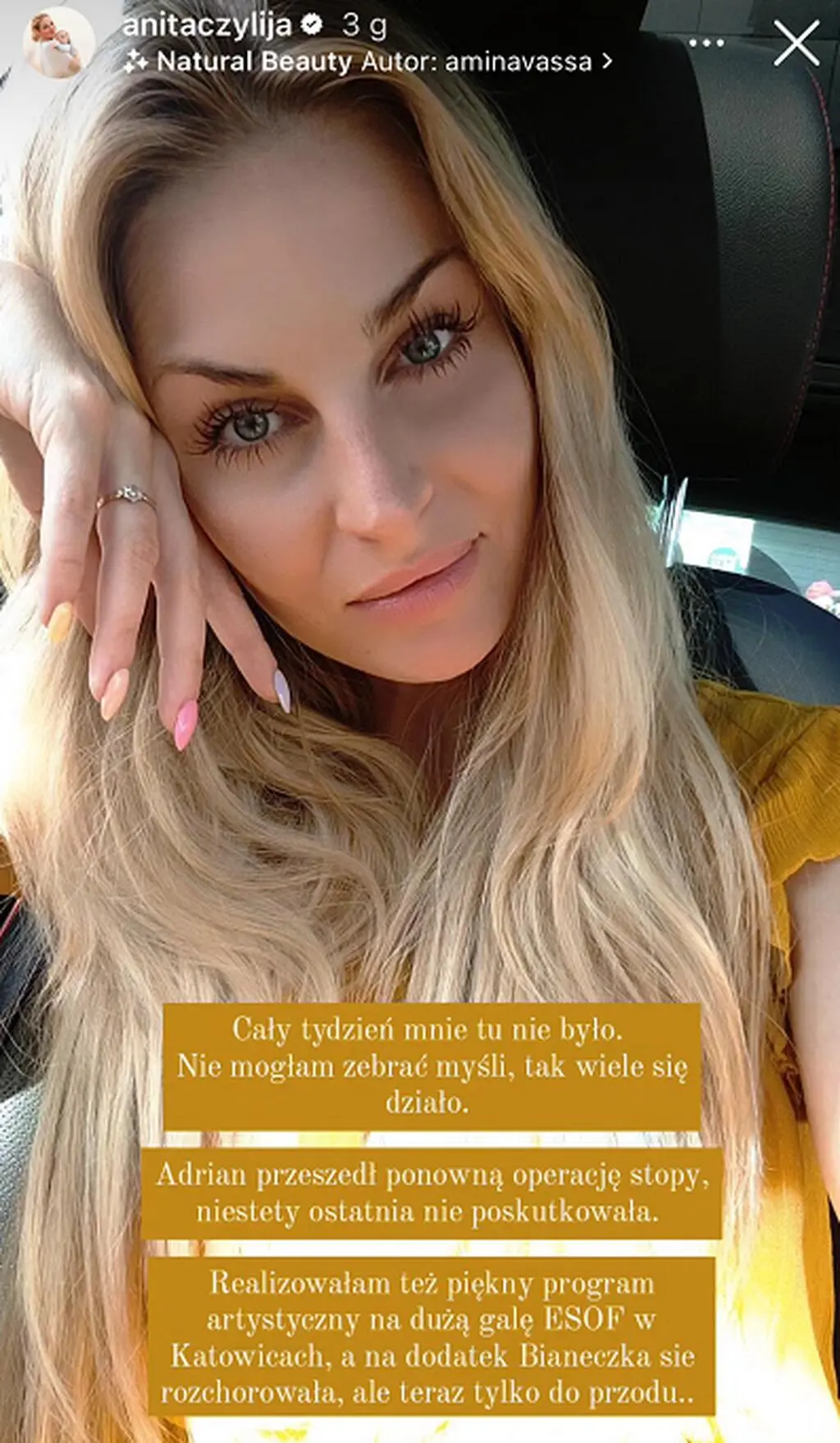 Anita Szydłowska
