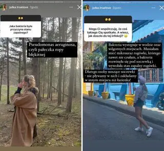 Julia z "True Love" o problemach z okiem. Były poważniejsze niż sądziła