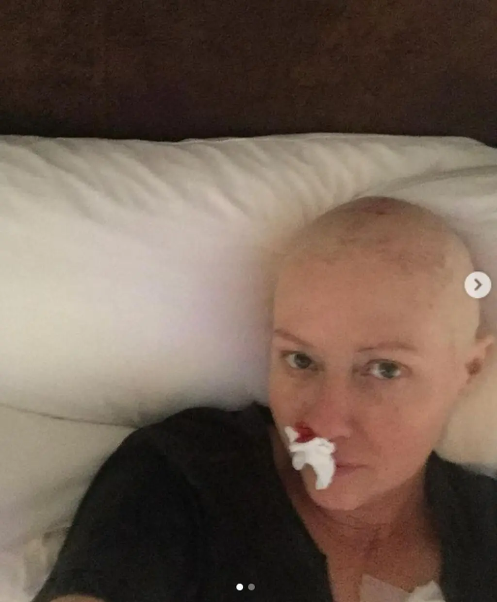 Shannen Doherty o samopoczuciu po chemioterapii