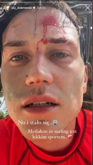 Jay z "Hotelu Paradise" miał wypadek