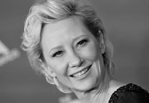 Anne Heche nie żyje. Aktorka została odłączona od aparatury podtrzymującej życie