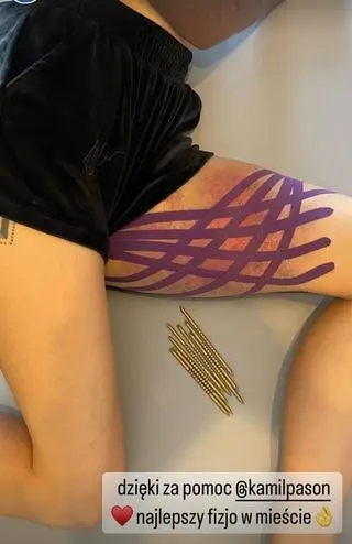 Ola z "HP" miała wypadek