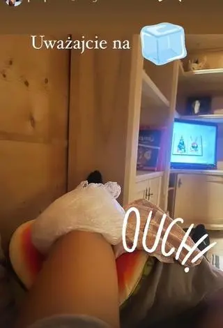 Paulina Krupińska miała mały wypadek