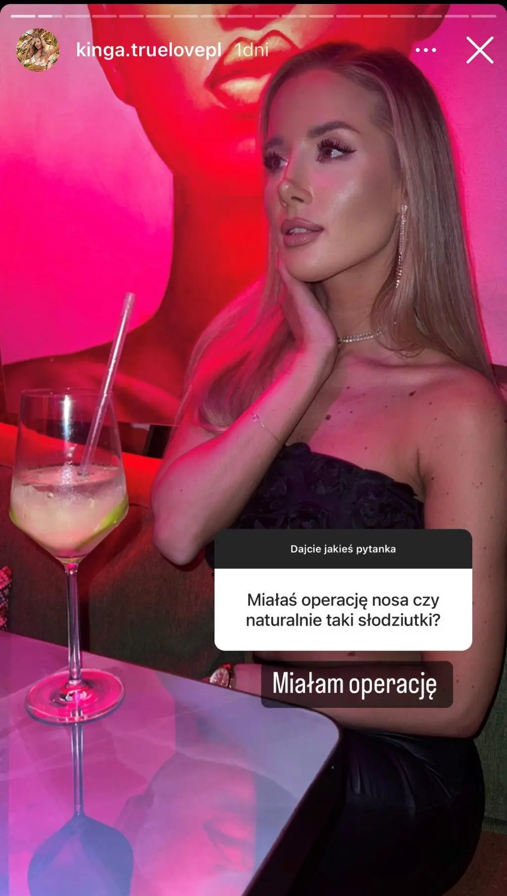 Kinga Mendrala z "True Love" o operacji nosa