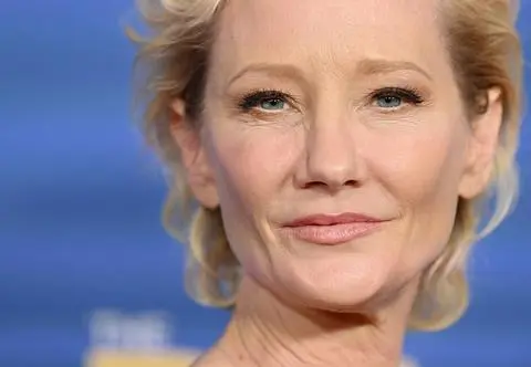 Anne Heche miała wypadek. Nowe informacje na temat stanu aktorki