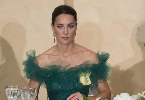 Na głowie księżnej Kate zauważono dużą bliznę. Jest oświadczenie z Pałacu Buckingham