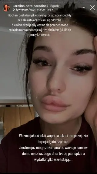 Karolina "Mallu" Majewska ma problemy ze zdrowiem