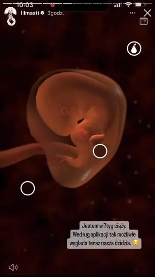 Aniela "Lil Masti" Bogusz jest w ciąży 