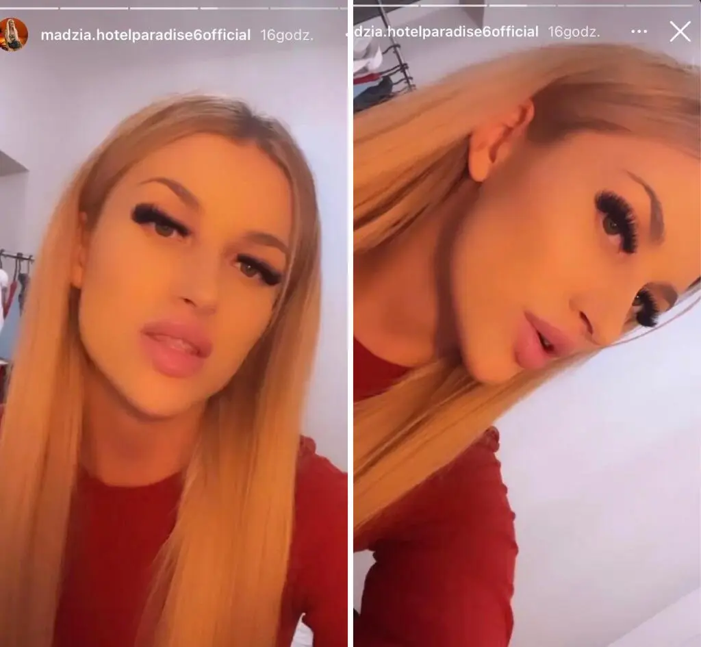 Magdalena z "Hotelu Paradise" poprawiła urodę. "Jestem bardzo zadowolona"