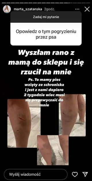 "Top Model": Marta Szatańska