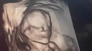 Chrissy Teigen podzieliła się rezultatem ciążowego USG na swoim instagramowym profilu