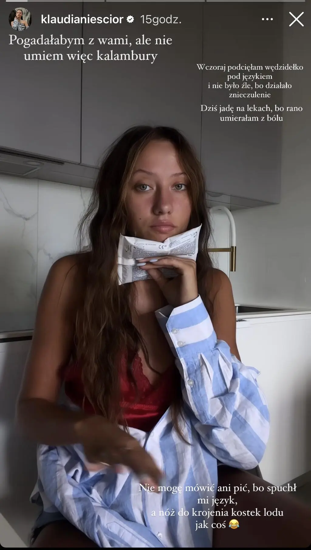 Klaudia Nieścior z "Top Model" o zabiegu