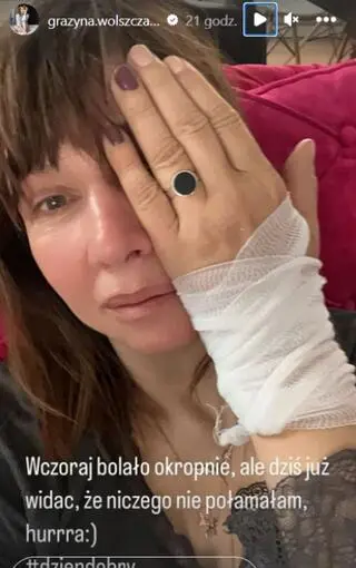 Grażyna Wolszczak pokazała odniesioną kontuzję 