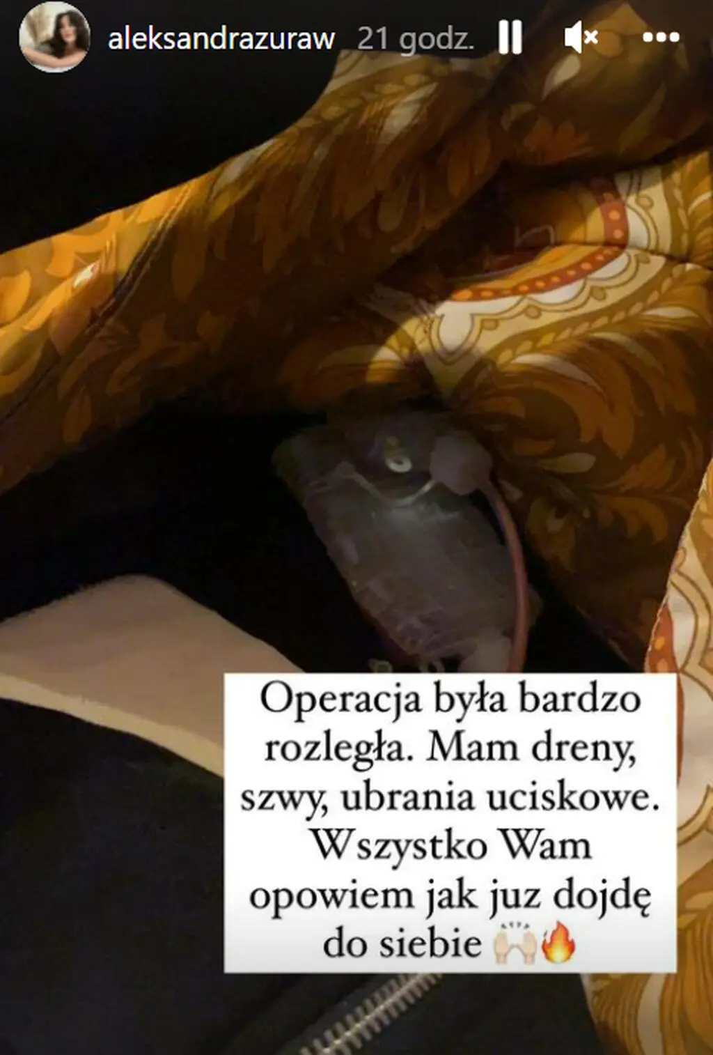 Ola Żuraw pokazała zdjęcia po operacji