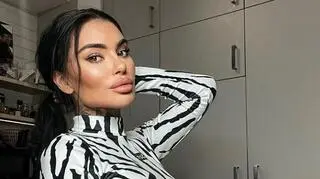 Anna Renusz z TTV przejdzie serię operacji. Wyjaśniła, co się stało