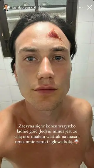 Jay z "Hotelu Paradise" miał wypadek