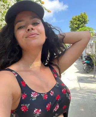 Amira z "40 kontra 20" zakrywa swoją bliznę