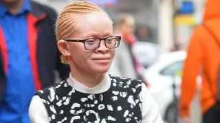 Ojciec Kabuli zlecił okaleczenie córki? "Nieraz zastanawiam się, po co ja się w ogóle urodziłam"