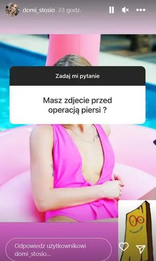 Dominika z "HP" pokazała, jak wyglądały jej piersi przed operacją